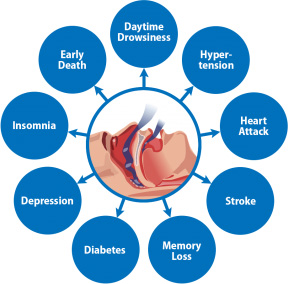 Can Sleep Apnea Kill You? Here Are the Results From A Recent Study ...