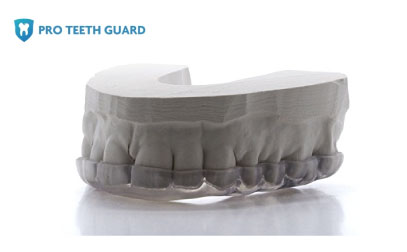 How Long Does A Night Guard Last? - Pro Teeth Guard
