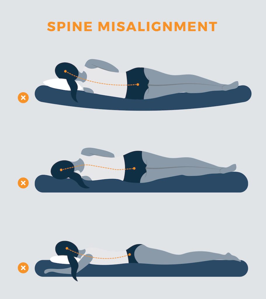 A graphic showing the ways that a mattress can cause back pain through misalignment