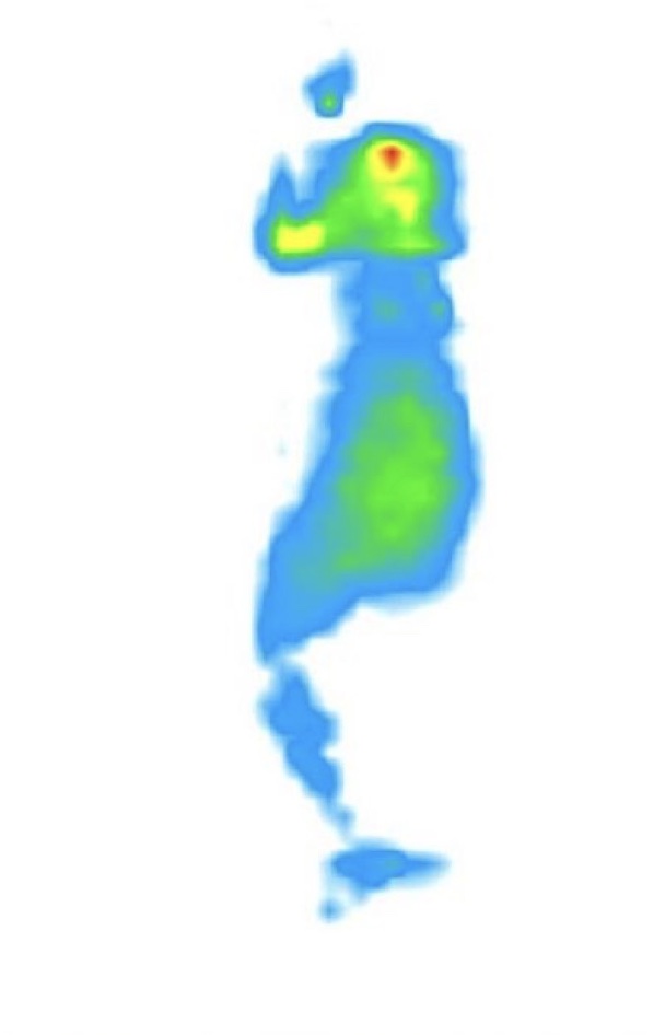 A pressure map of someone side sleeping on the DreamCloud Premier