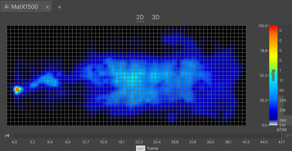 Bear Pro Hybrid Back Sleeping Pressure Map