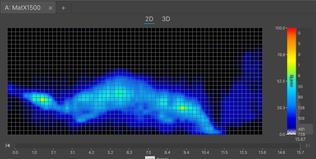 Emma Mattress Side Sleeping Pressure Map